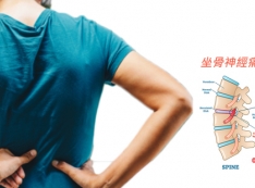 【推薦】消滅坐骨神經痛不必挨刀！　勤練「3式舒緩妙招」讓筋骨軟回來